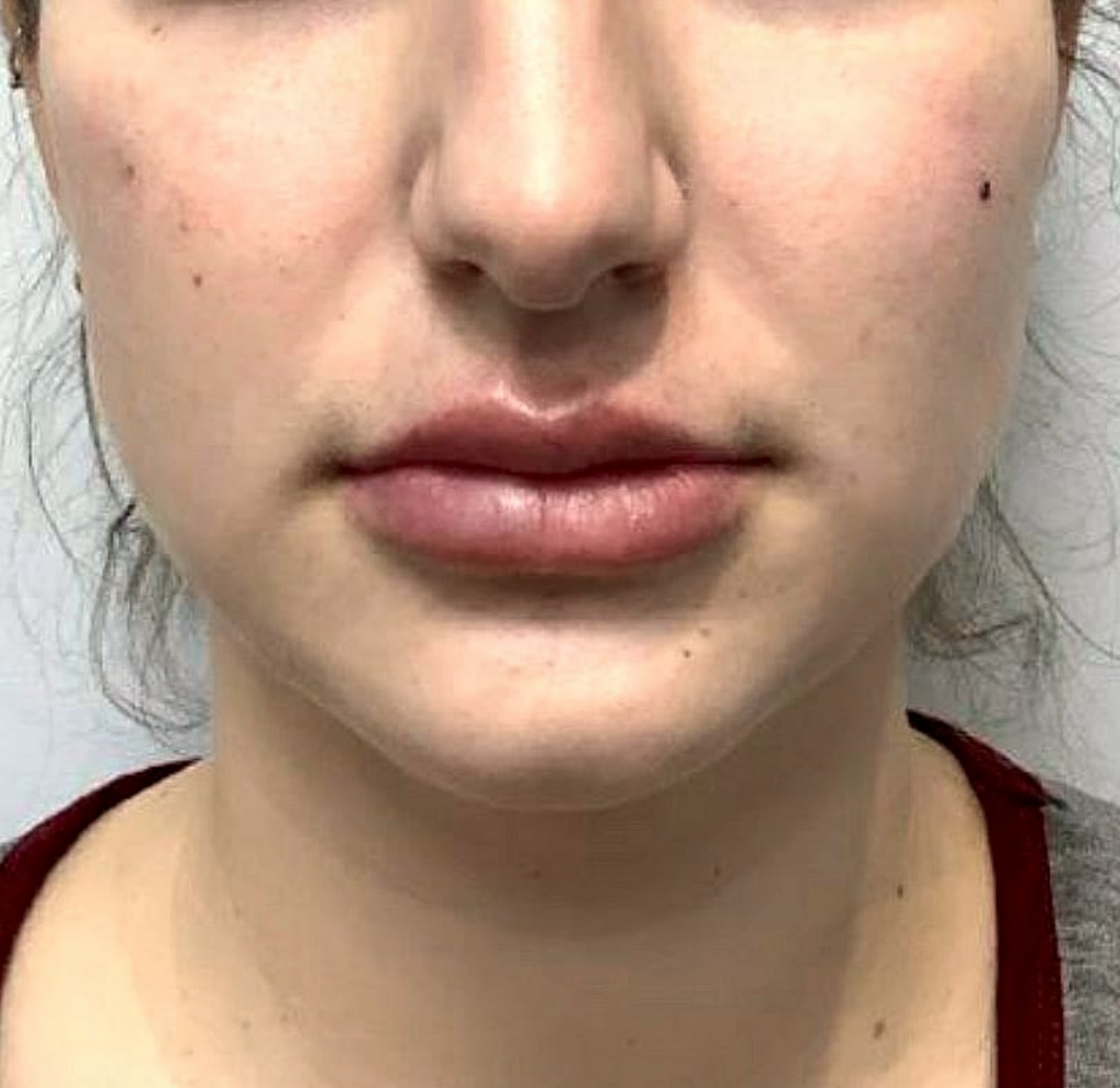 Beautera Clinic | 122 Lakeshore Rd W, Oakville, ON L6K 1E3, Canada | Phone: (437) 999-4055