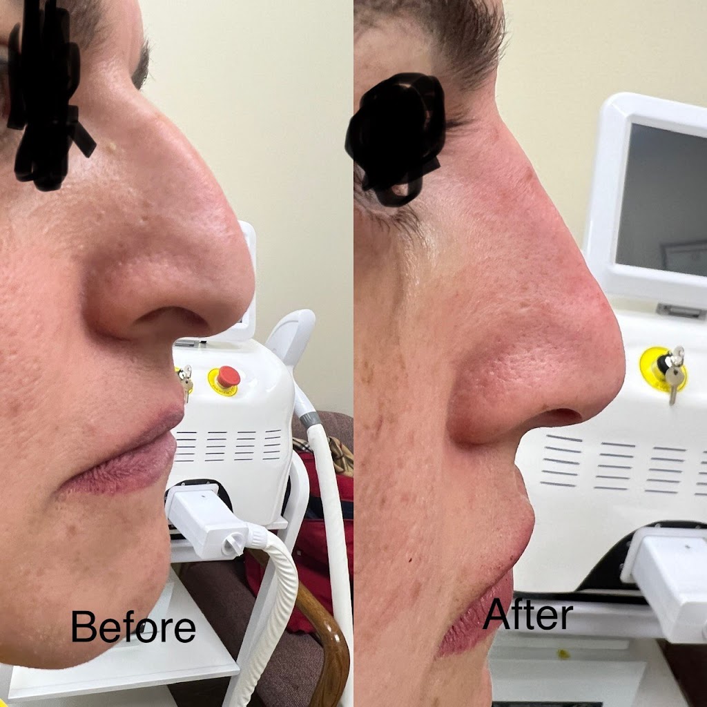 Richmond Hill Cosmetic Clinic ( Dr. Amir Mirkeshmiri) | 10376 Yonge St Unit.106, Richmond Hill, ON L4C 3B8, Canada | Phone: (416) 890-0024