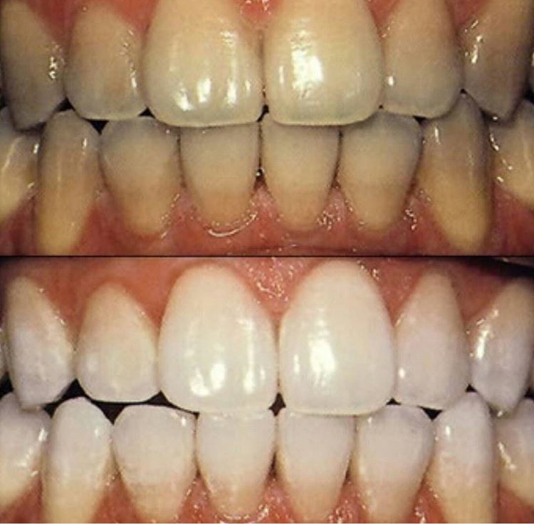 Tooth Care Centre | 6061 York Regional Rd 7, Markham, ON L3P 3B2, Canada | Phone: (905) 554-3555