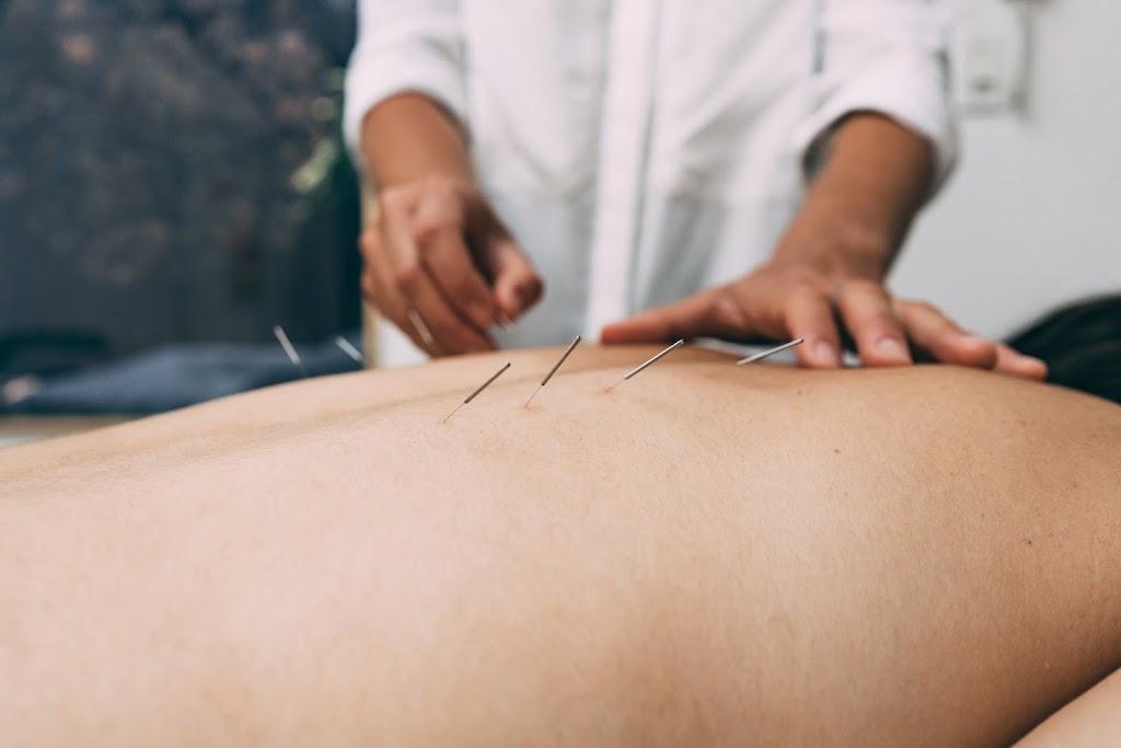 Acupuncture Eastman - Sophie Latreille acupuncteur | 13 Rue Lapointe, Eastman, QC J0E 1P0, Canada | Phone: (514) 912-7674