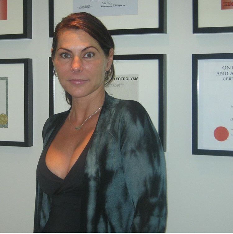 Fox Facials & Electrolysis | 885 Meadowlands Drive West, Ottawa, ON K2C 1N6, Canada | Phone: (613) 866-6314