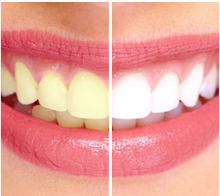 Hillsborough Dental Centre | 108 Corporate Dr Unit 18, Toronto, ON M1H 3H9, Canada | Phone: (416) 289-7373