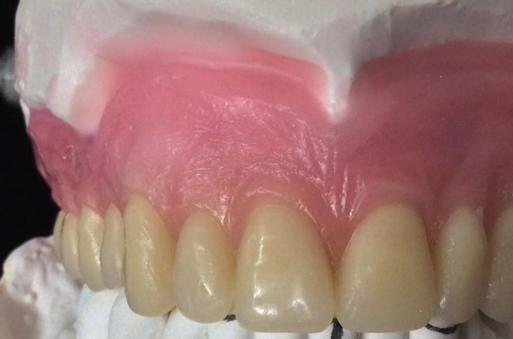 Aline Delfosse et Associés Denturologiste | 3125 Montée Saint-Hubert, Saint-Hubert, QC J3Y 4J2, Canada | Phone: (450) 676-3279