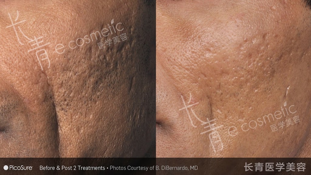 长青医学美容 - Evergreen Cosmetic | 500 Royal Oak Dr NW #216, Calgary, AB T3G 5J7, Canada | Phone: (403) 680-9960