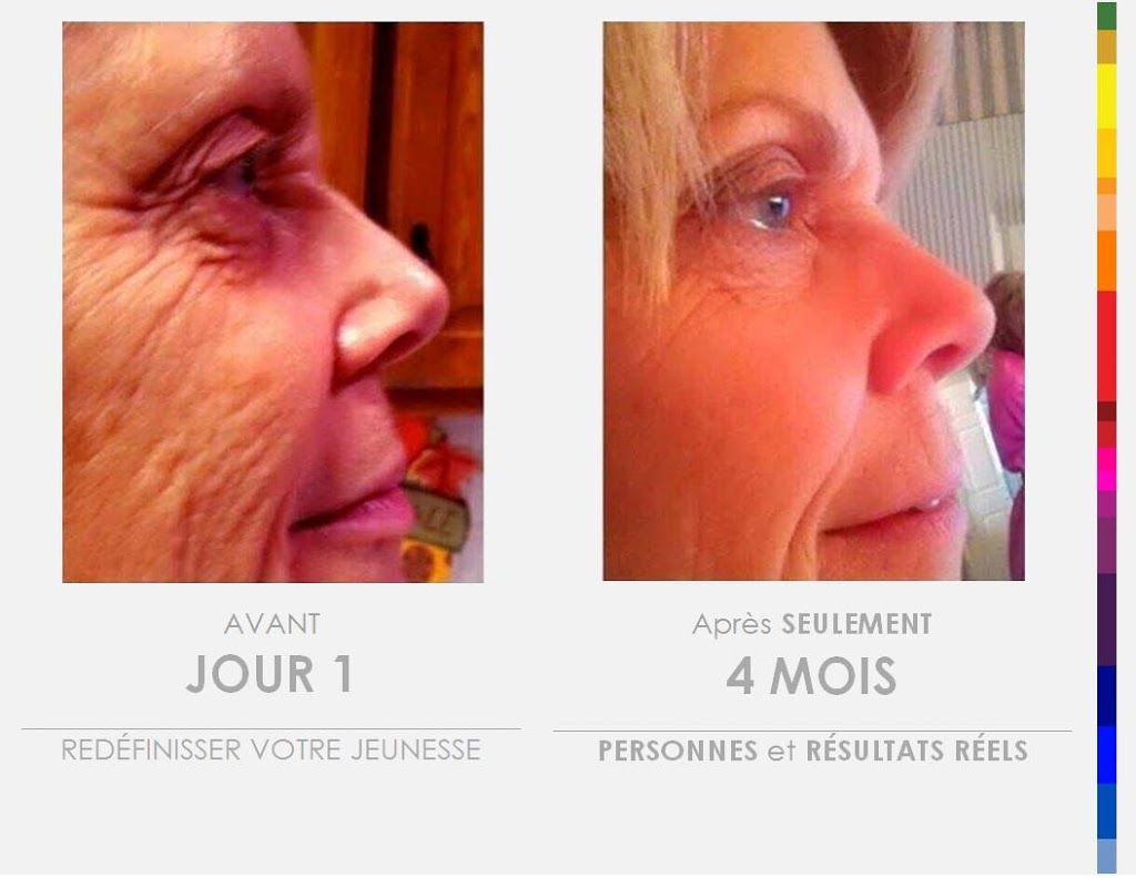 evolution beaute | 1172 Rue Saint Louis, Saint-Jean-Chrysostome, QC G6Z 2L2, Canada | Phone: (418) 956-9488