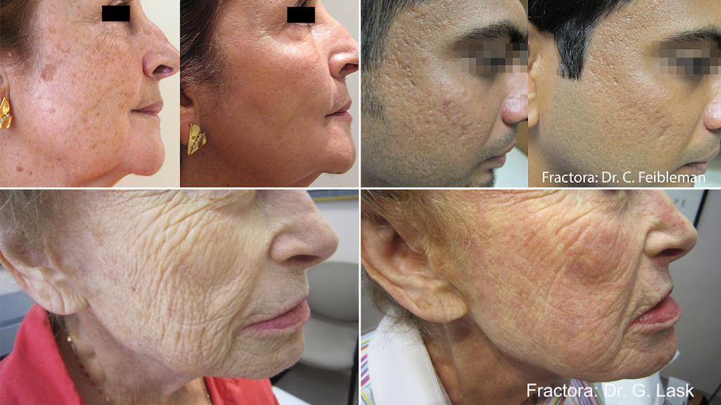Silverado Medical & Aesthetic Clinic | 802-810, 19369 Sheriff King Street SW, Calgary, AB T2X 0T9, Canada | Phone: (403) 873-7300