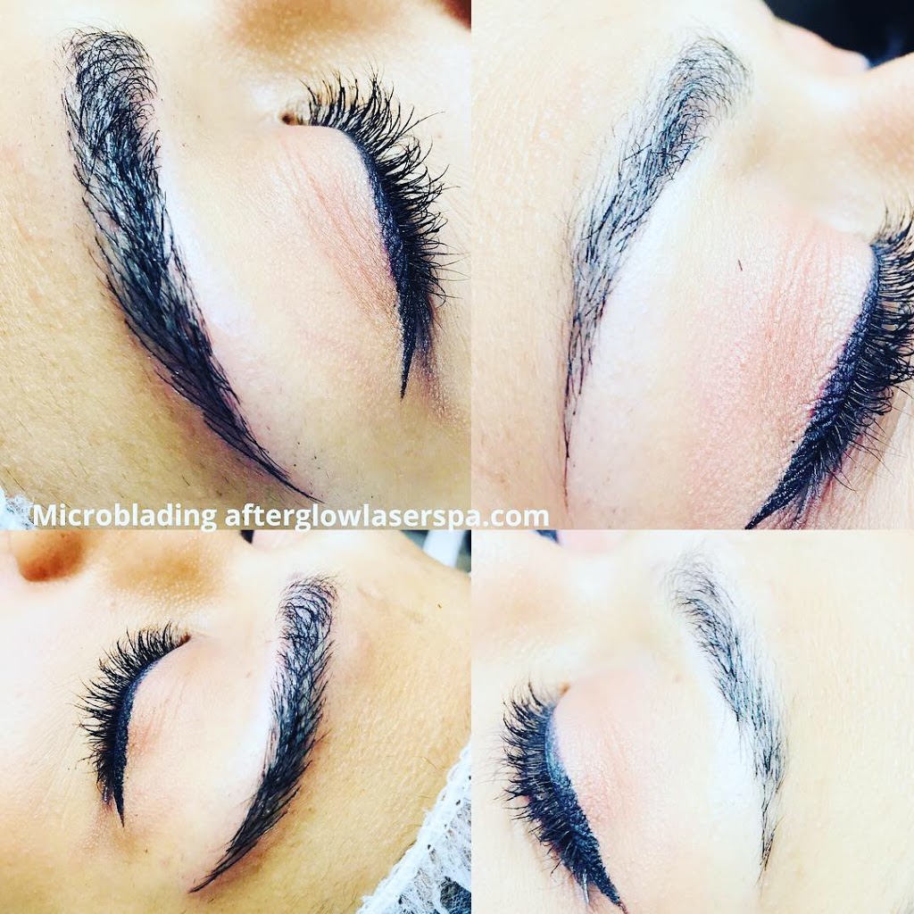 Afterglow Laser Spa | 310 Wellington Rd Unit J, London, ON N6C 4P4, Canada | Phone: (519) 601-0081