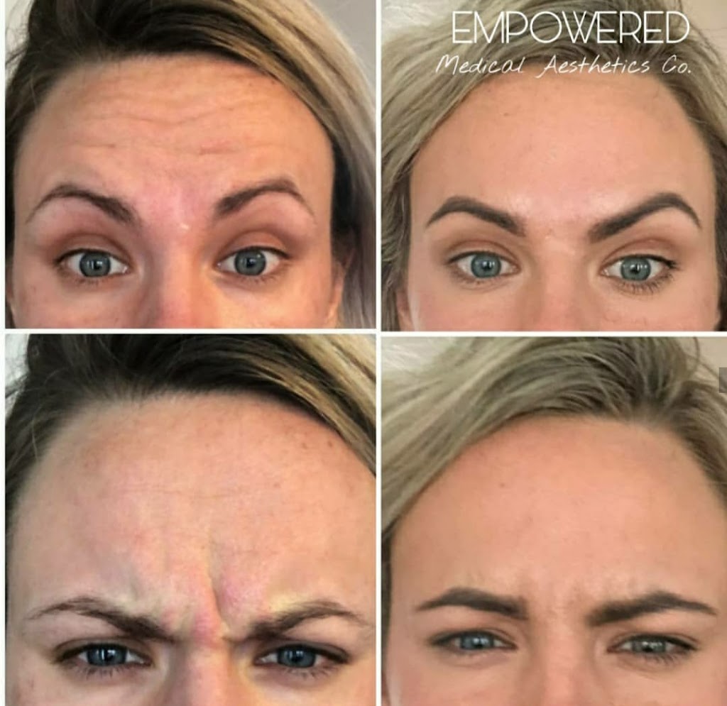 Empowered Medical Aesthetics Co. | 353 Manly St, Midland, ON L4R 3E1, Canada | Phone: (519) 216-8673