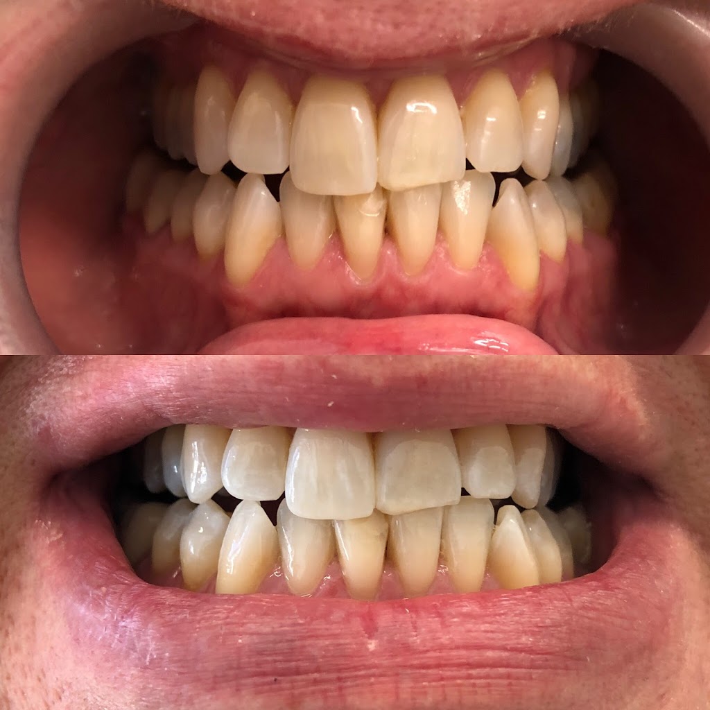Glow Dental Hygiene Clinic | 10 Strada Dr unit 5, Woodbridge, ON L4L 5W1, Canada | Phone: (905) 265-8343