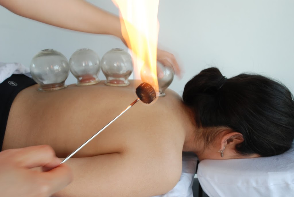 Bahareh Hosseini, Registered Acupuncturist, Shiatsu Therapist | 116 Church St S, Richmond Hill, ON L4C 1W3, Canada | Phone: (905) 883-9355