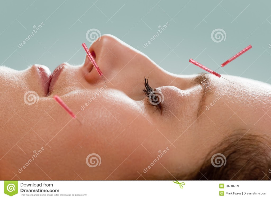 North Shore Acupuncture | 640 Jones Ave, North Vancouver, BC V7M 2V6, Canada | Phone: (604) 728-4325