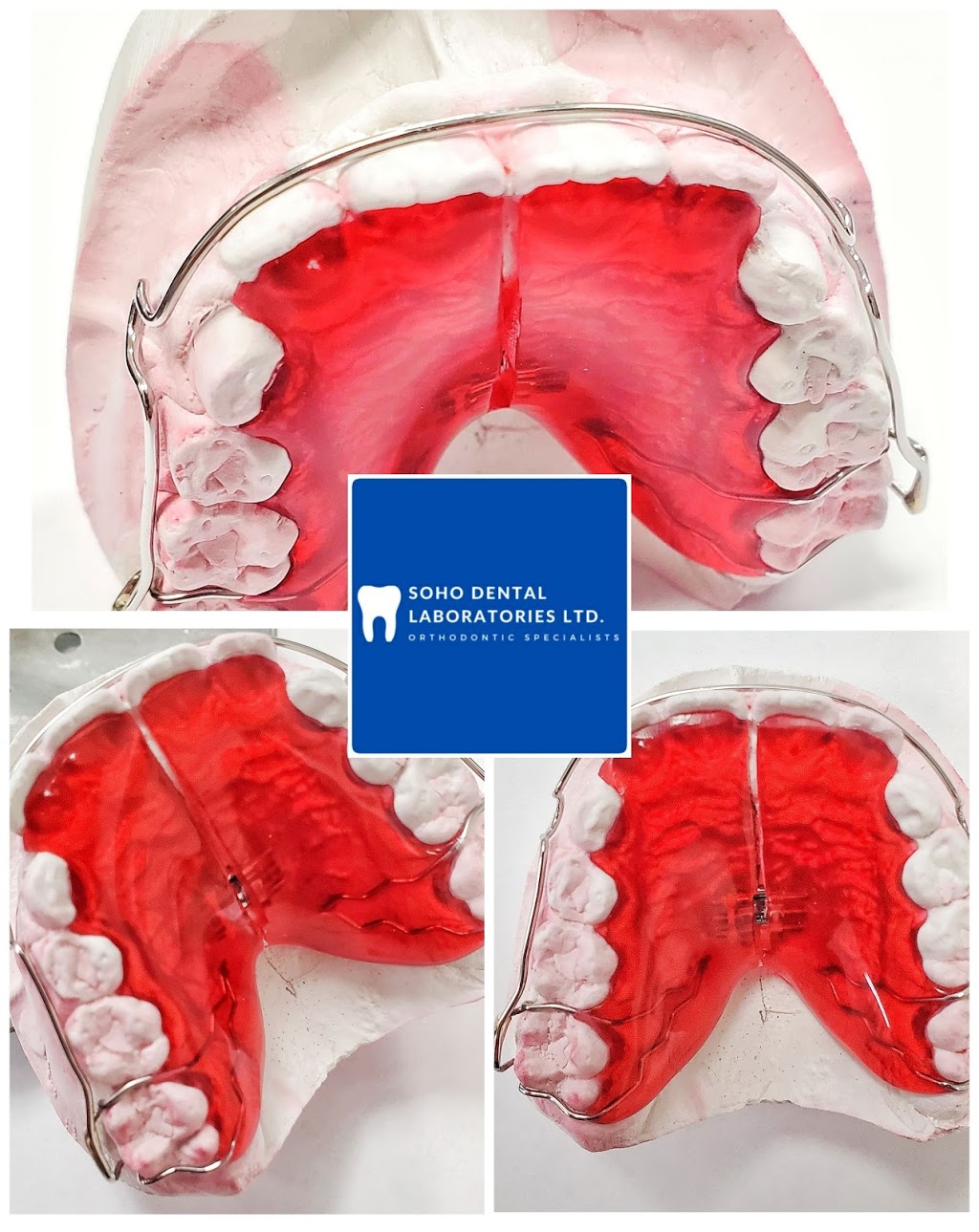 Soho Dental Laboratories Ltd | 4008 Deane Pl, North Vancouver, BC V7G 2P3, Canada | Phone: (604) 722-4855