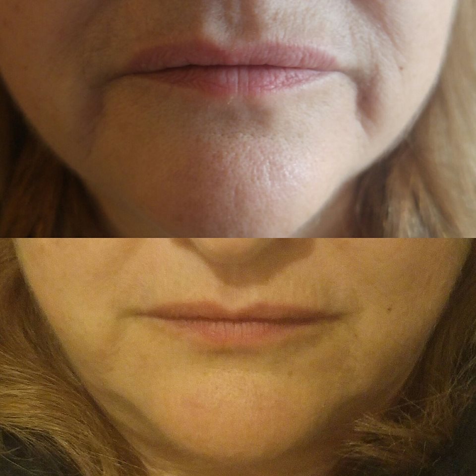 Alexs Beauty Bar | 34 Kidd Street, Bradford, ON L3Z 0V5, Canada | Phone: (416) 274-6805
