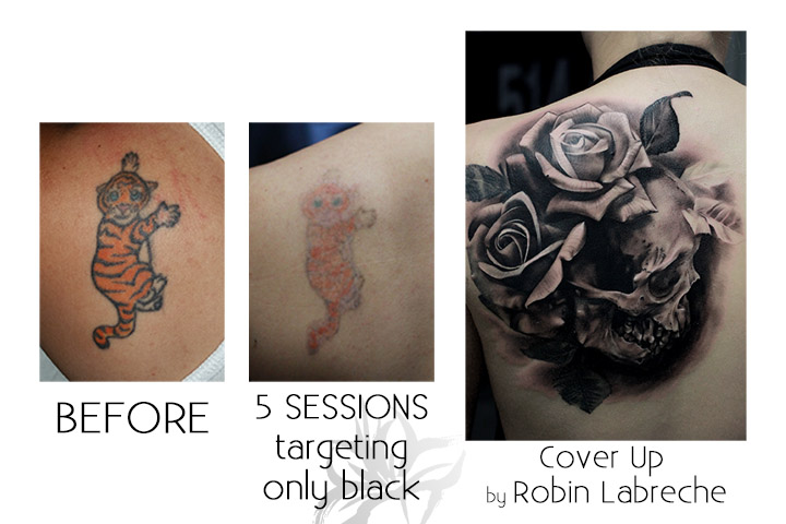 Azalea Laser Clinic | 7567 Blvd. Newman, LaSalle, QC H8N 1X3, Canada | Phone: (844) 429-2532