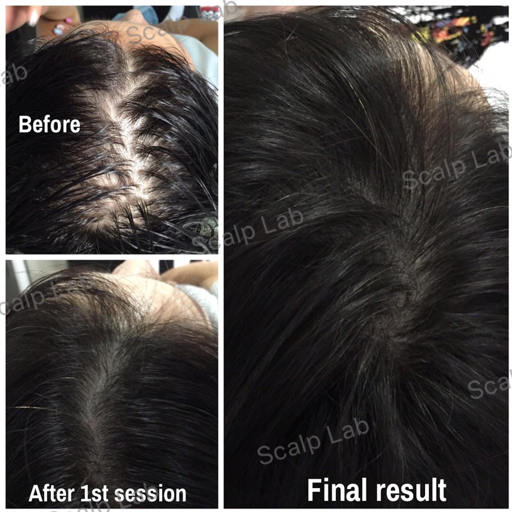 Scalp Lab | 135 Village Green Square, Scarborough, ON M1S 0G4, Canada | Phone: (416) 823-9300
