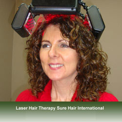 Sure Hair International | 55 Wyndham St N Suite T7, Guelph, ON N1H 7T8, Canada | Phone: (416) 747-7873