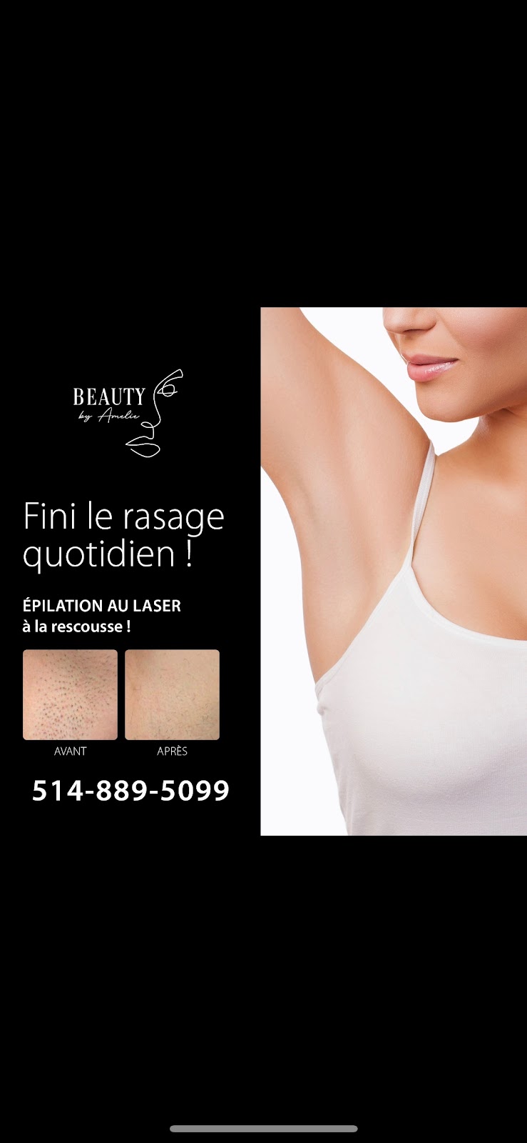 Beauty By Amelie Laser & Esthétique | Rue Victor, Mirabel, QC J7J 1B4, Canada | Phone: (514) 889-5099