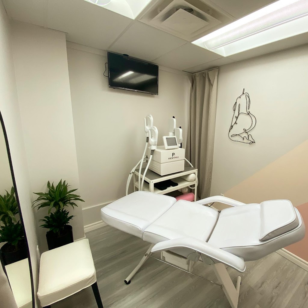 Snatched by Ale Fat Freezing | 59 Cathedral High St Unit 1, Markham, ON L6C 0P1, Canada | Phone: (647) 806-5353