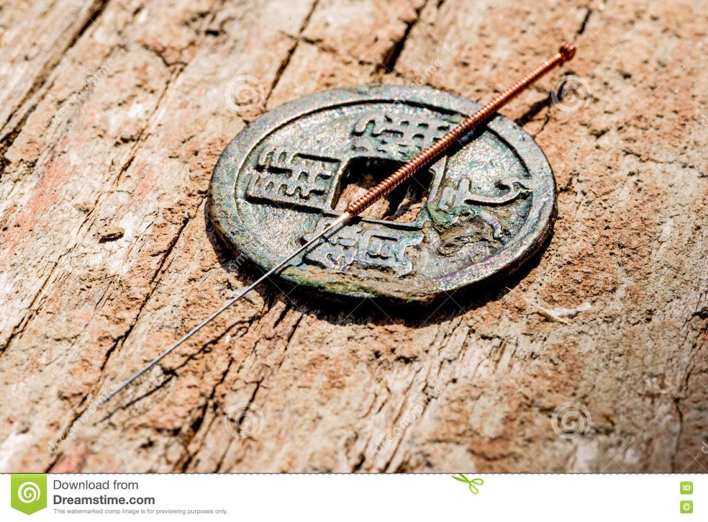 North Shore Acupuncture | 640 Jones Ave, North Vancouver, BC V7M 2V6, Canada | Phone: (604) 728-4325