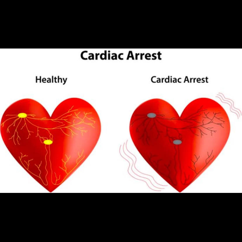 Vita First Aid - AED / Portable Defibrillator Specialists | 99 Crompton Dr, Barrie, ON L4M 6P1, Canada | Phone: (833) 428-3233