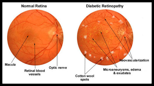 Conestoga Eye Care | 550 King St N, Waterloo, ON N2L 5W6, Canada | Phone: (519) 747-2222