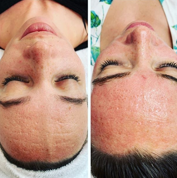 Jada Skin and Health Institute | 3030 Pandosy St #213, Kelowna, BC V1Y 0C4, Canada | Phone: (778) 581-7675