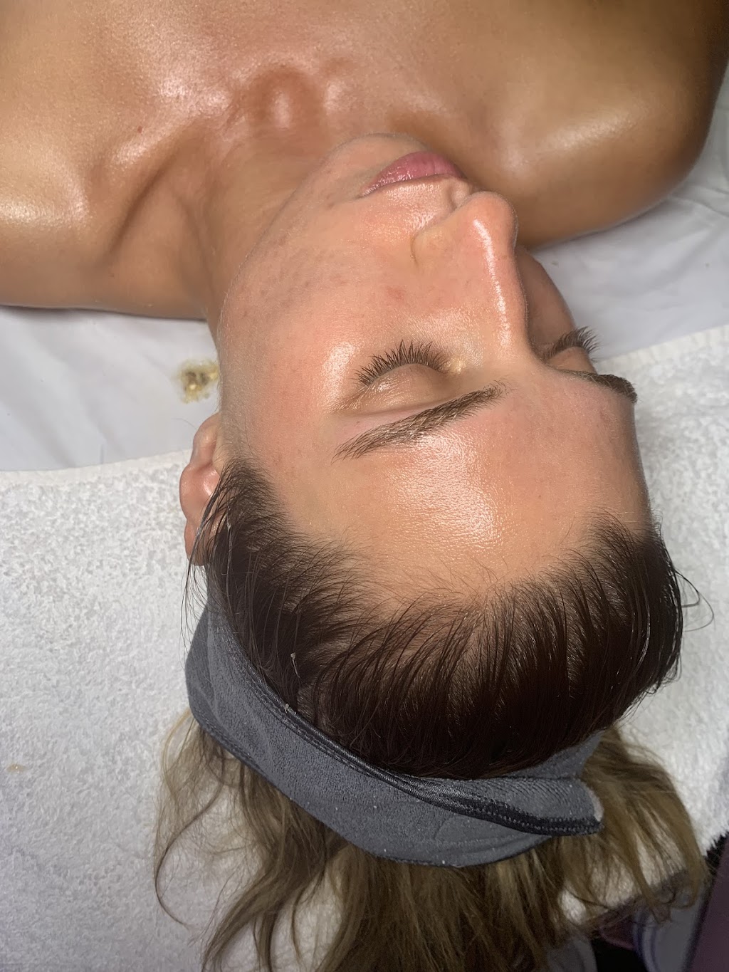 Clinique Skin by Eryka | 9 Avenue de la Baie-de-la, Av. de la Baie de Valois suite 3, Pointe-Claire, QC H9S 5H2, Canada | Phone: (514) 577-0605