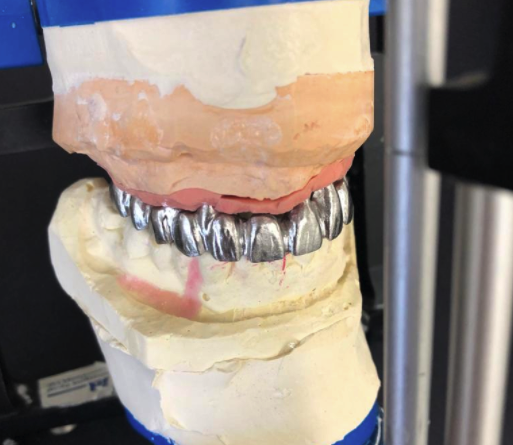 Innovative Dental Laboratories | 1706 Danforth Ave, Toronto, ON M4C 1H8, Canada | Phone: (416) 463-3138