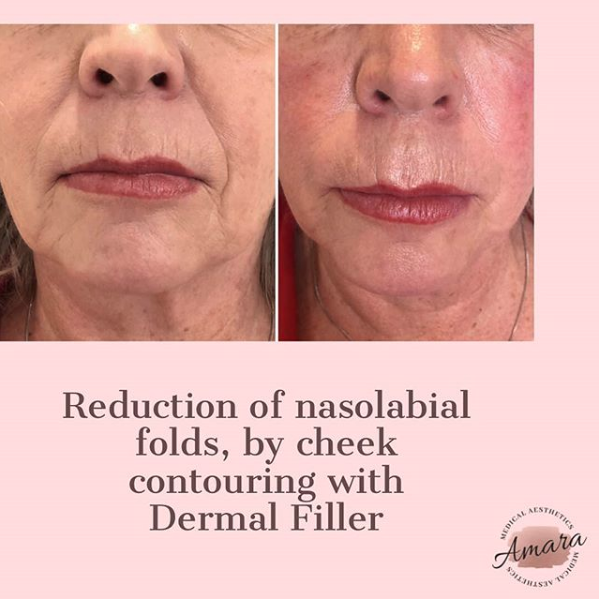 Amara Medical Aesthetics | 670 Upper James St, Hamilton, ON L9C 2Z3, Canada | Phone: (289) 674-9577