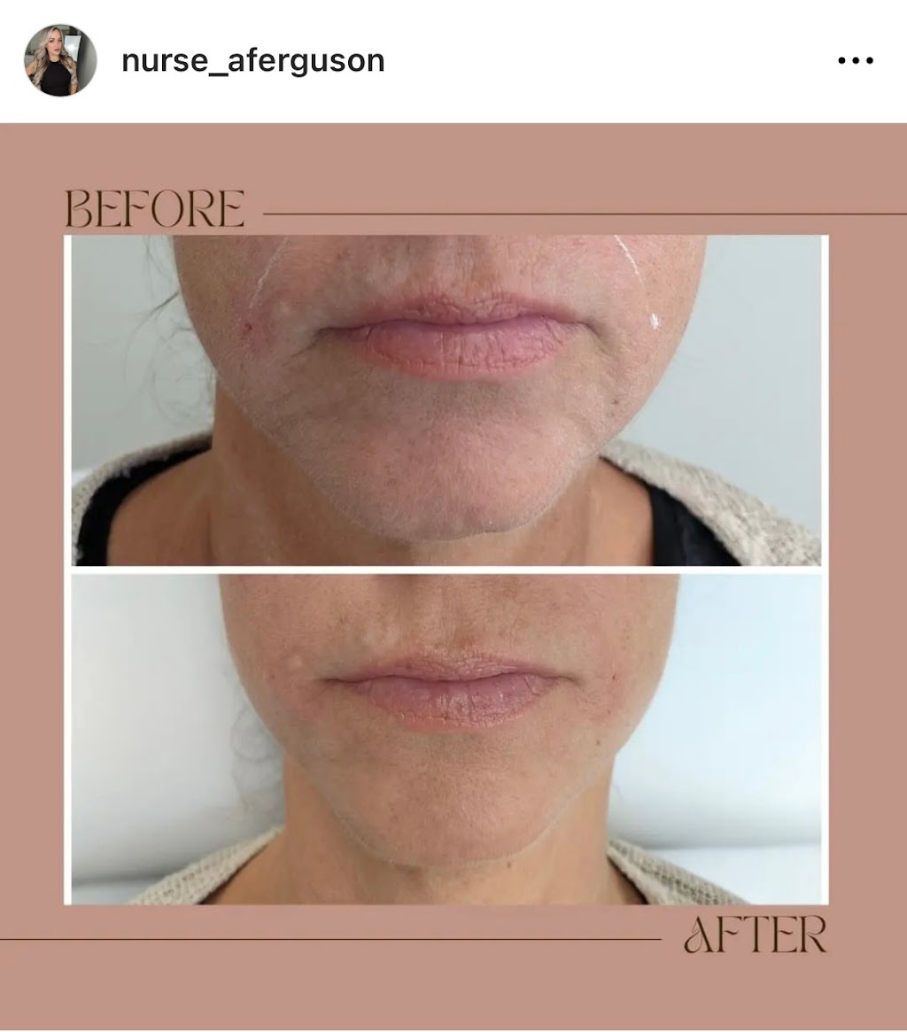 Monarchy Medispa Halifax | 480 Parkland Dr, Halifax, NS B3S 1P9, Canada | Phone: (902) 457-0525