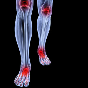 Tsawwassen Podiatrist Dr. Dixon | 218- BC V4L 2A2, 1077 56 St, Delta, BC V4L 2A2, Canada | Phone: (604) 943-4405