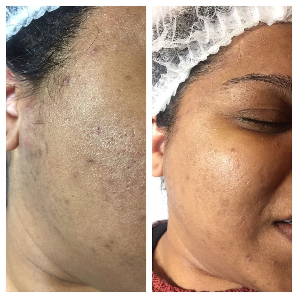 NR Laser & Spa | 7088 Justine Dr, Mississauga, ON L4T 1M3, Canada | Phone: (647) 269-1045