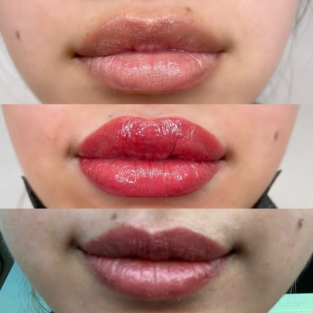 Natali Lischinski Medical Aesthetics & Cosmetic Tattoo | 8 Cooks Mill Crescent, Maple, ON L6A 0K8, Canada | Phone: (416) 700-3855