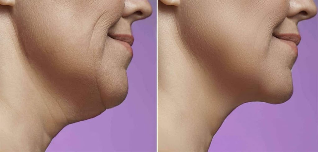 NuSkin Cosmetic Laser Clinic | Call for locations near you, 9991 Hwy 7, Kawartha Lakes, ON K9H 0A1, Canada | Phone: (705) 991-4767