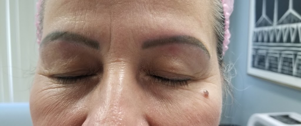 IC Skin Care | 428 Legacy Point SE, Calgary, AB T2X 0Y8, Canada | Phone: (587) 888-4660