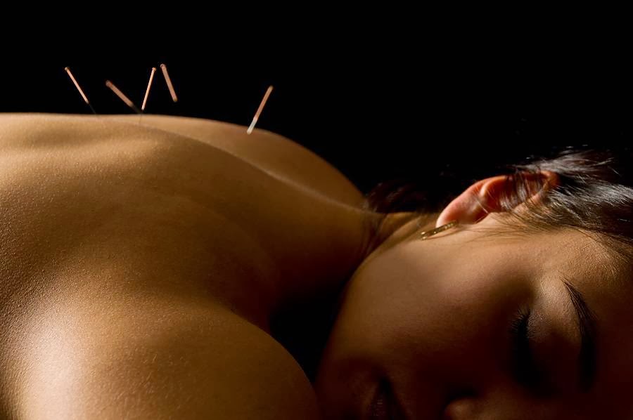 PossAbility Acupuncture | 15 Shirk Pl, Kitchener, ON N2K 1R3, Canada | Phone: (519) 504-6727