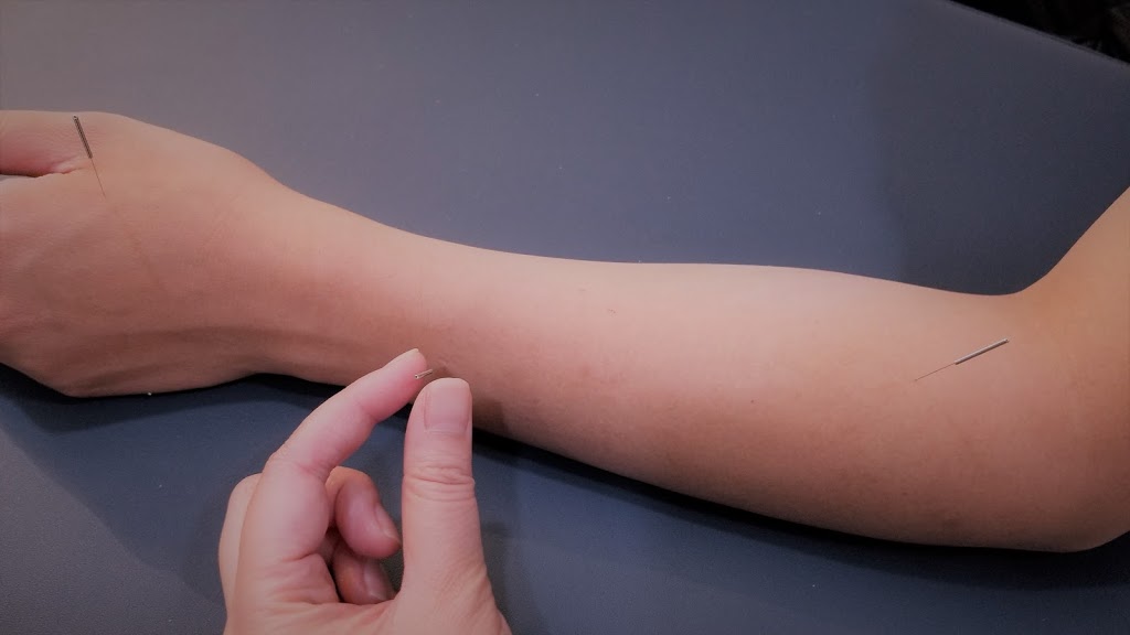 Simple Root Acupuncture Clinic | 5586 Windermere Blvd #204, Edmonton, AB T6W 2Z8, Canada | Phone: (780) 988-4488