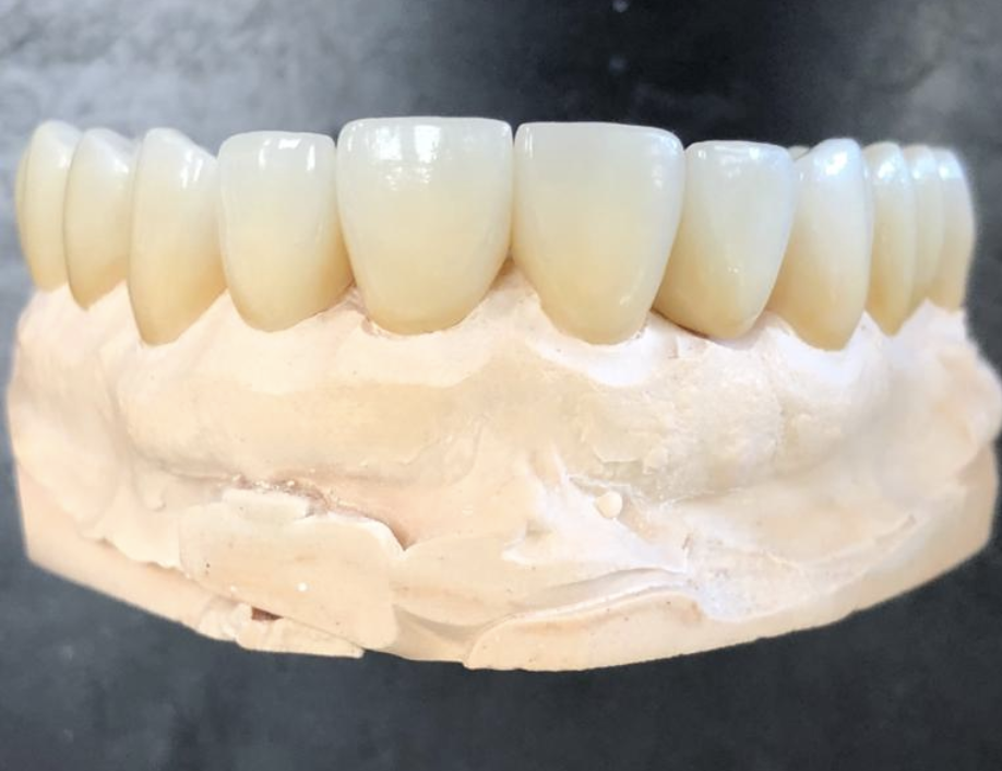 Innovative Dental Laboratories | 1706 Danforth Ave, Toronto, ON M4C 1H8, Canada | Phone: (416) 463-3138