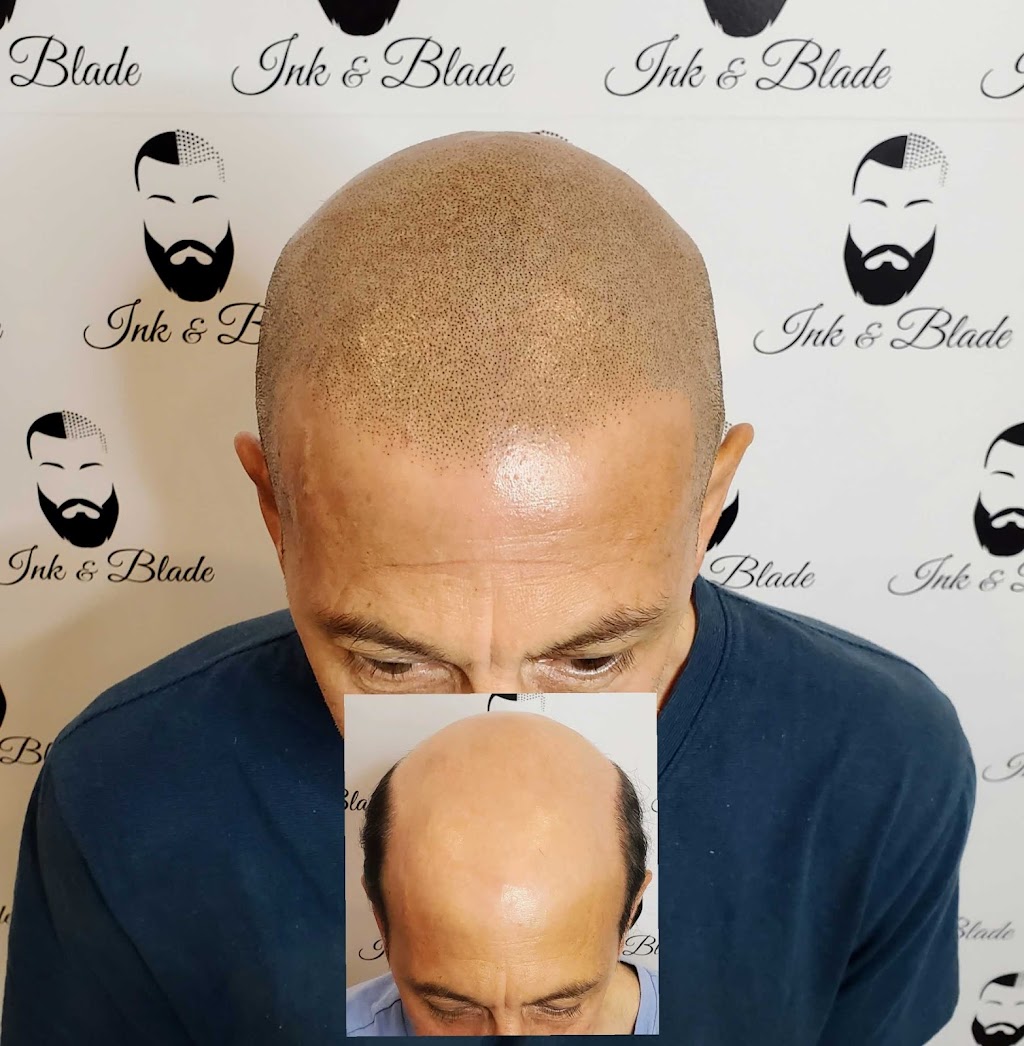 Ink and Blade - Micropigmentation Capillaire | 87 Boulevard Saint-Elzéar O, Laval, QC H7M 1E7, Canada | Phone: (438) 879-2417