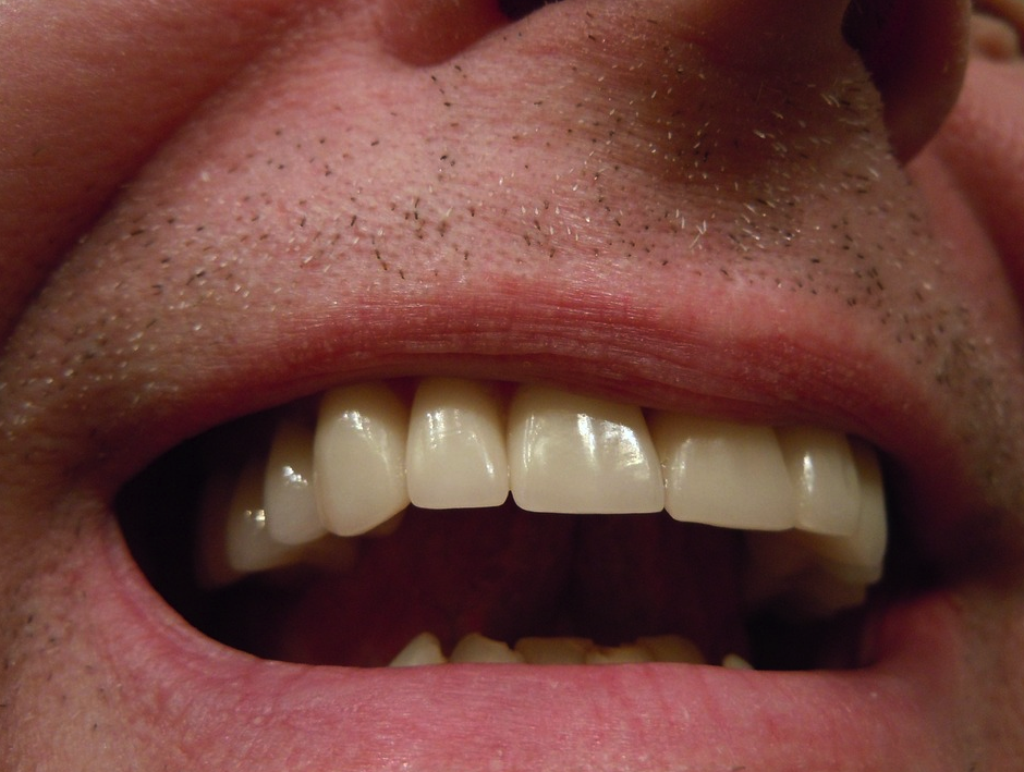 Aline Delfosse et Associés Denturologiste | 3125 Montée Saint-Hubert, Saint-Hubert, QC J3Y 4J2, Canada | Phone: (450) 676-3279