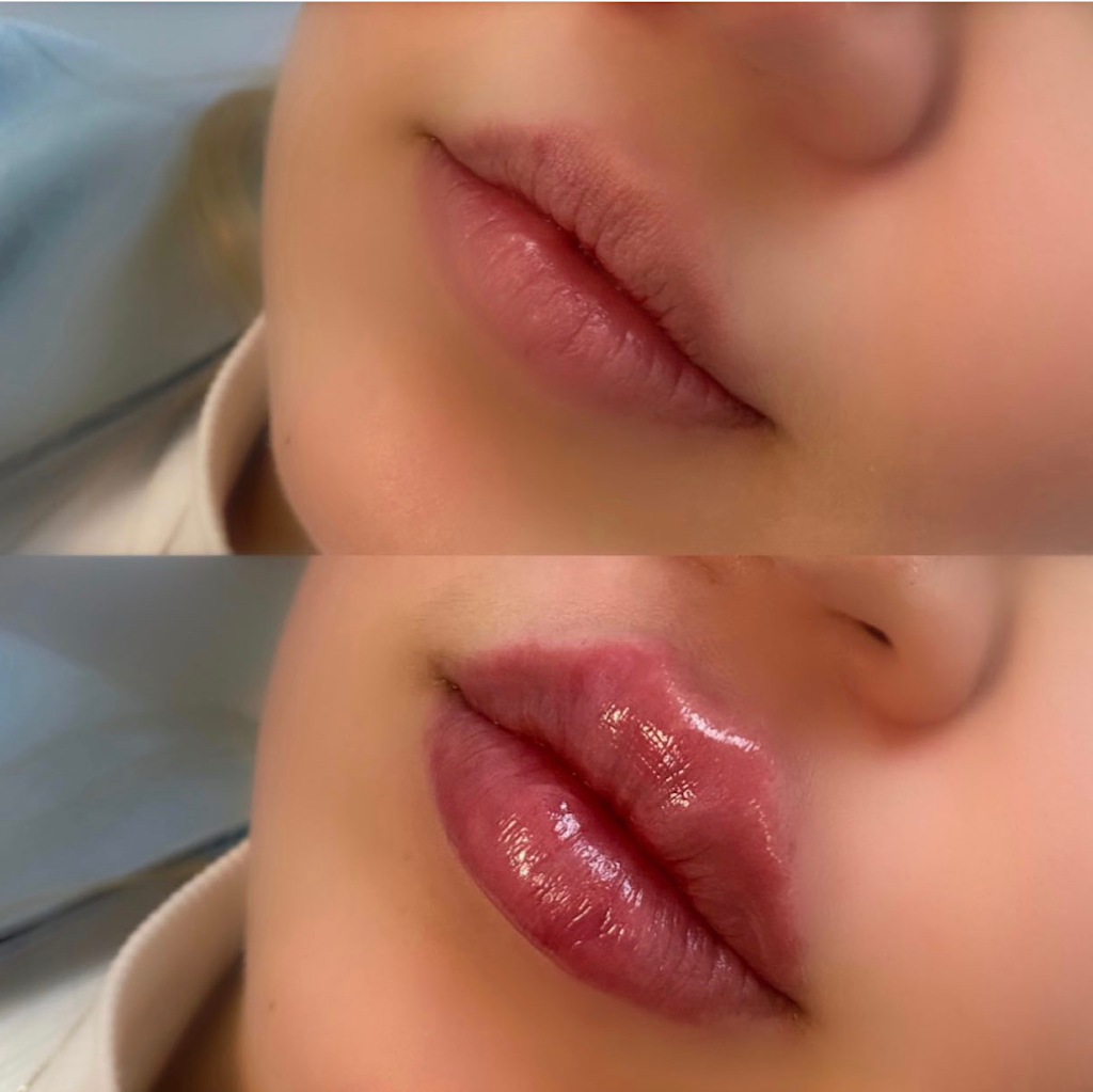 Luxe Beauté Clinic Canada - Cosmetic Dermatology | 875 Bank St, Ottawa, ON K1S 3W4, Canada | Phone: (613) 793-8987