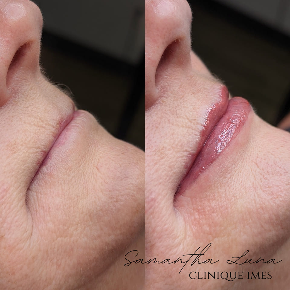 Clinique IMES | 6805 Rte Louis-S.-Saint-Laurent, Compton, QC J0B 1L0, Canada | Phone: (819) 345-4900