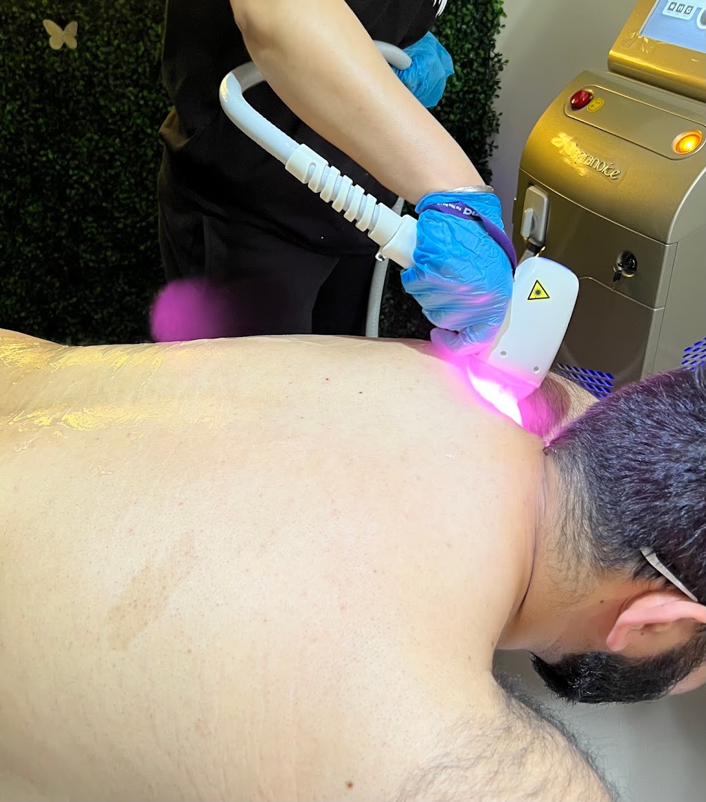 Laser by Gigi | 21 Banks St, Brantford, ON N3T 0H7, Canada | Phone: (647) 539-4880