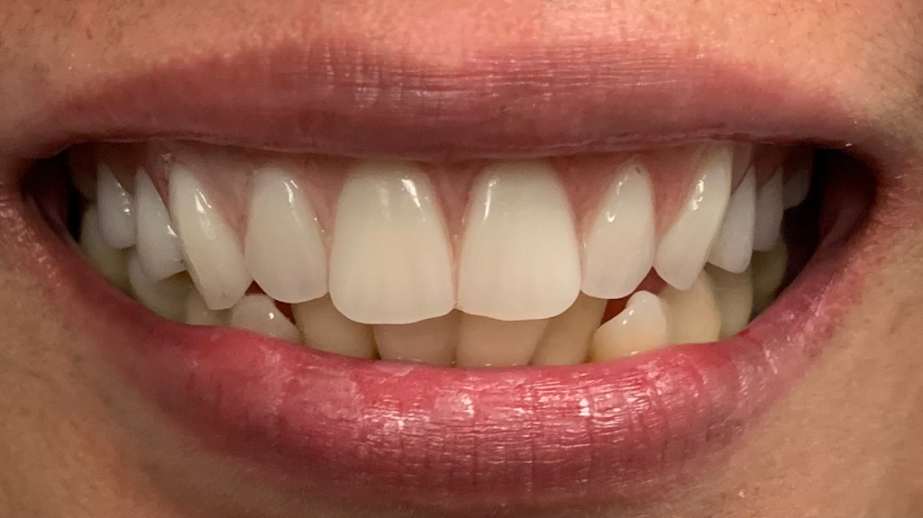 Alberta Dentures | 83 Deerpoint Rd SE #204, Calgary, AB T2J 6W5, Canada | Phone: (587) 966-3368