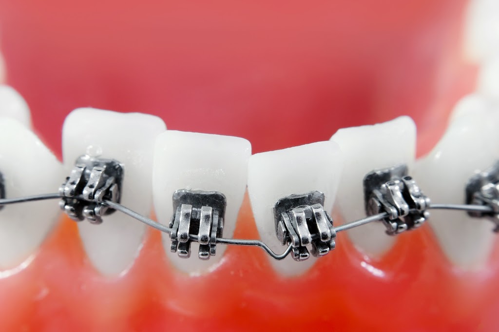 Hanoudi Dental | 1701 Simcoe St N, Oshawa, ON L1G 4Y1, Canada | Phone: (905) 723-2282