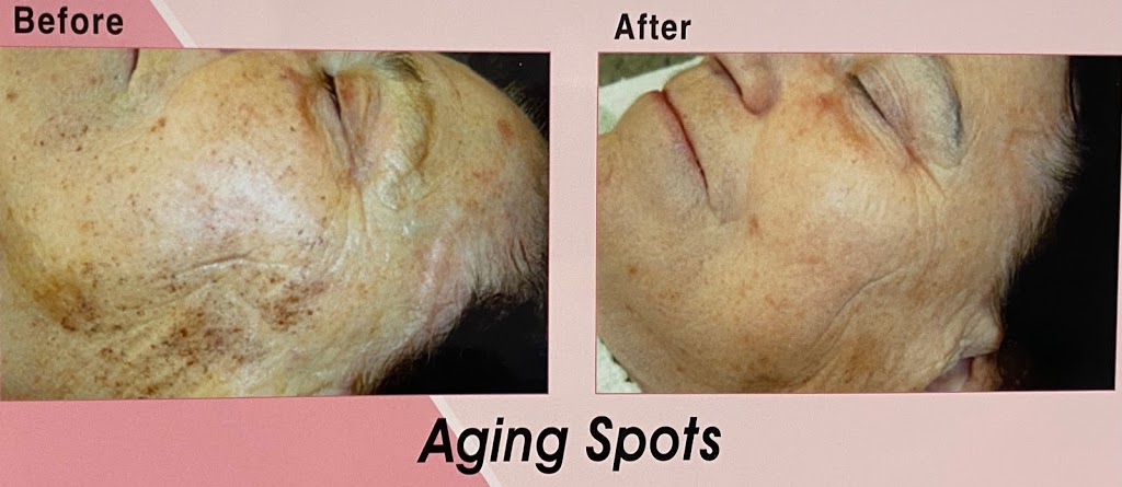 Laura Beauty & Laser Home Med Spa | 144 Solomon Crescent, Hamilton, ON L8W 2G7, Canada | Phone: (289) 775-8875