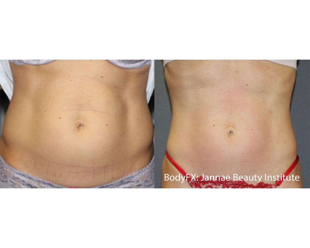 Elan Laser Aesthetics | 2258 Belmont Ct, Burlington, ON L7P 3N3, Canada | Phone: (905) 220-2258