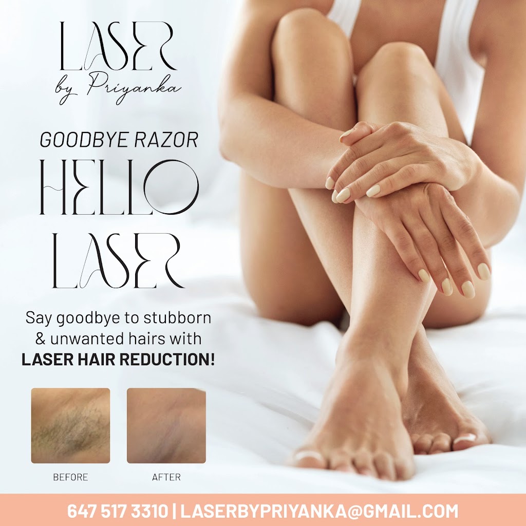 Laser By Priyanka | 16 Dowden Ave, Brantford, ON N2T 6N6, Canada | Phone: (647) 517-3310