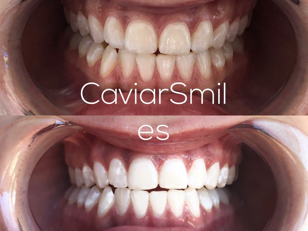 Caviar Smiles | 66 Walpole Ave #103, Toronto, ON M4L 3W5, Canada | Phone: (437) 220-9338