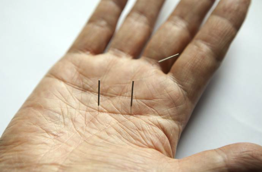 Acupuncture Marie-Pier Racine - Prévost _ | 2943 Boulevard du Curé-Labelle, Prévost, QC J0R 1T0, Canada | Phone: (450) 822-2677